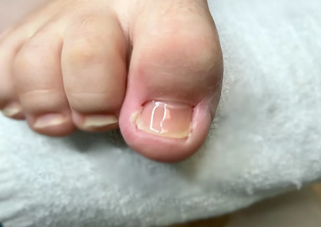 Antigravitációs körömszabályozás