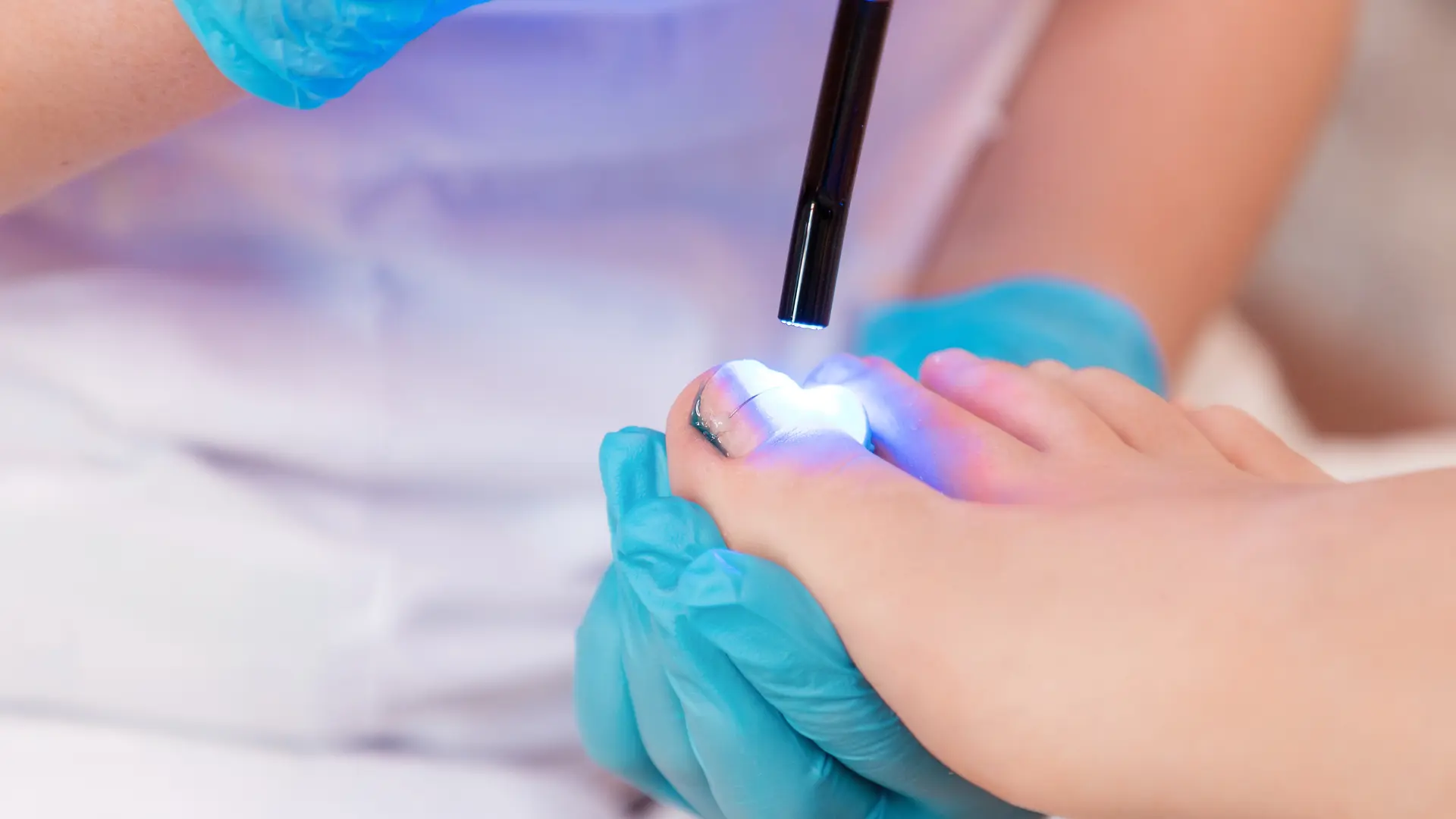 Körömszabályozás