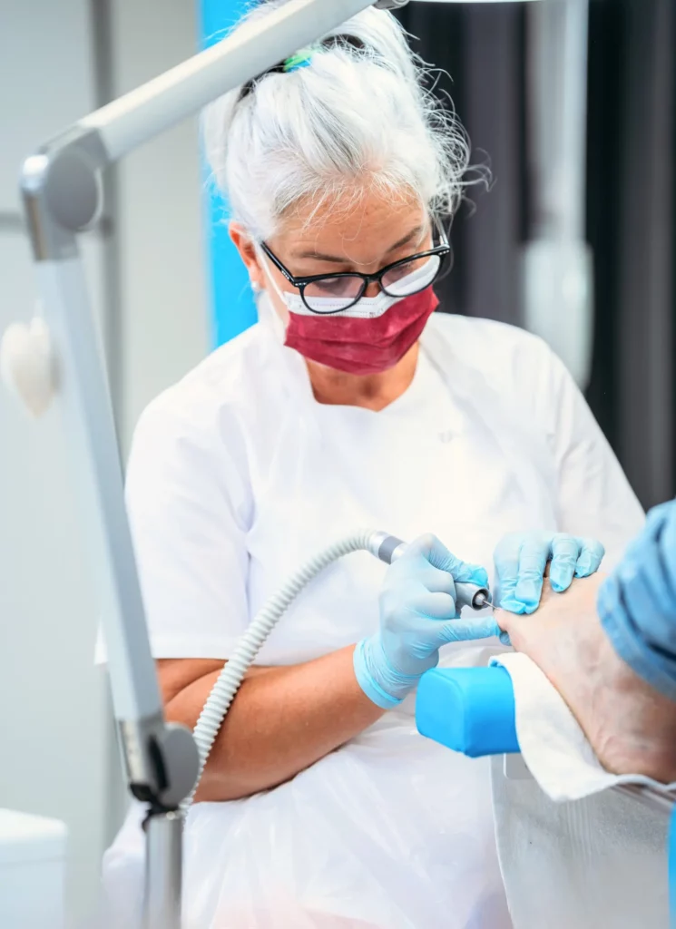 Körömszabályozás